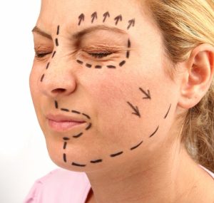 managing facelift surgery scars