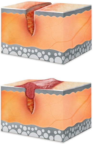 scar characteristics